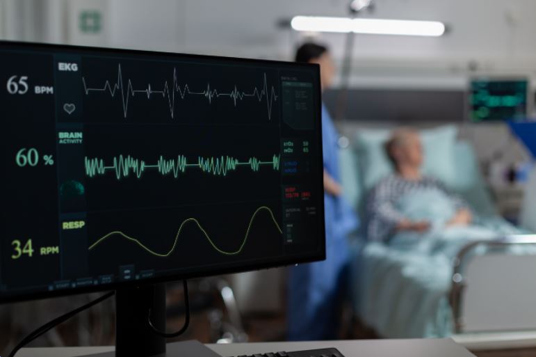 electrocardiograma